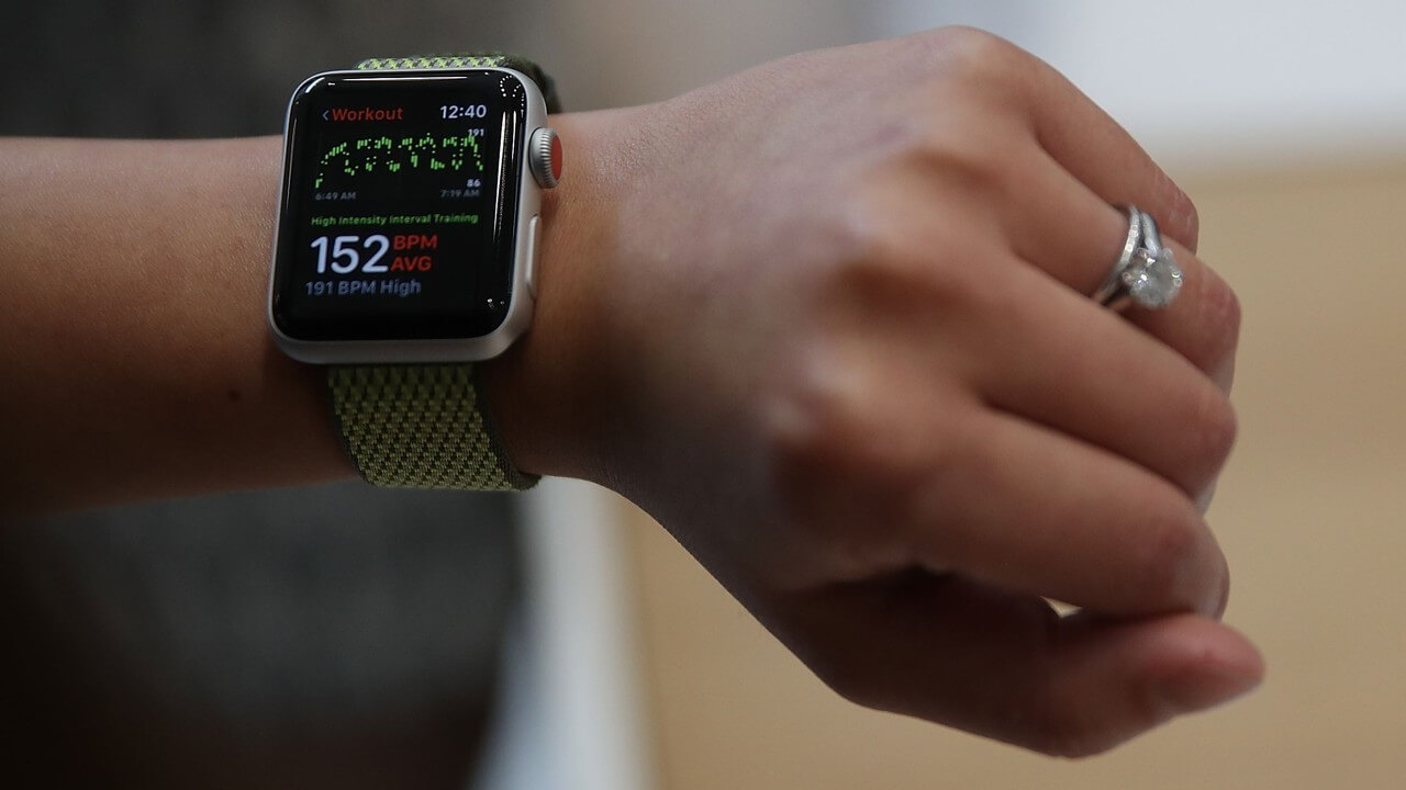 Apple Watch Heart Rate Sensor at the Center of a Possible Lawsuit Apple Watch