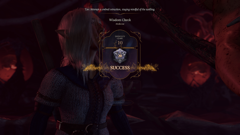 A skill check for brain removal in Baldur's Gate 3