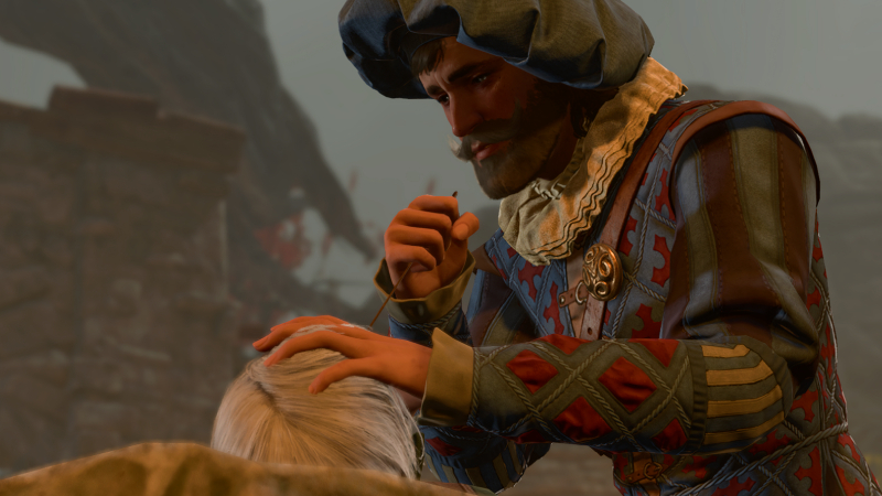 bg3 Ersatz Eye, baldurs gate 3 surgery, Mind Flayer Parasite