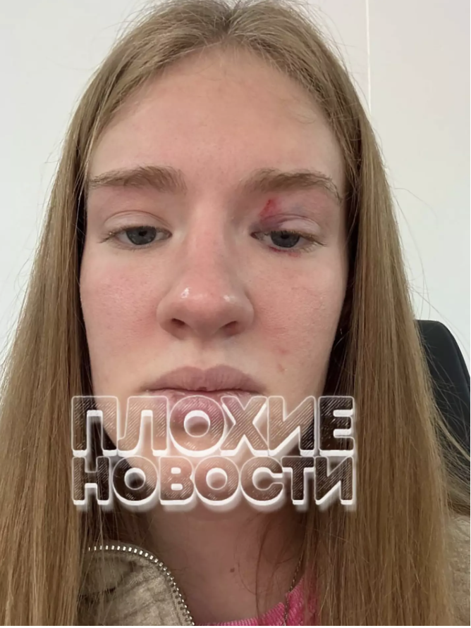 Masha, mermaid attacked by large fish in China