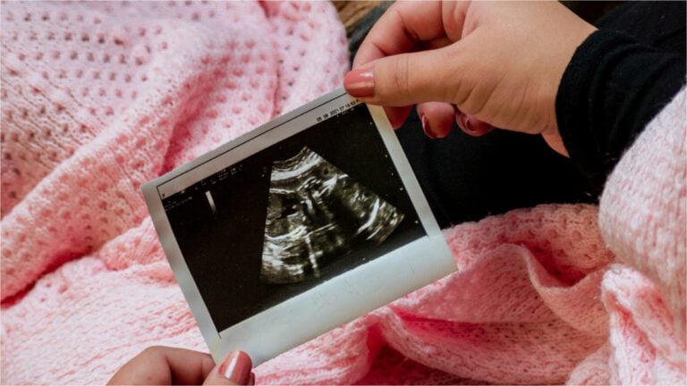 A woman holding an ultrasound photo