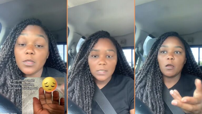 Shocked Florida Mother Recounts Terrifying Injury Daughter Sustained at Daycare 'This is Actually Unreal'