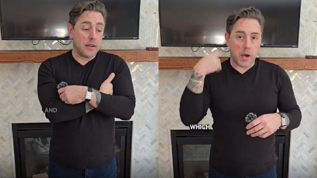 Minnesota Realtor Gets Detained and Injured For Simply Recording ICE Activity