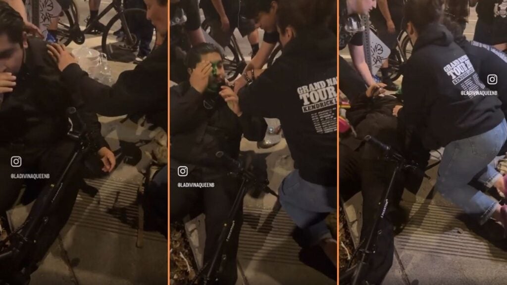 Injured By ICE Unarmed Los Angeles Protestor Blinded By Pepper Ball, 'It's Not Worth Losing an Eye'