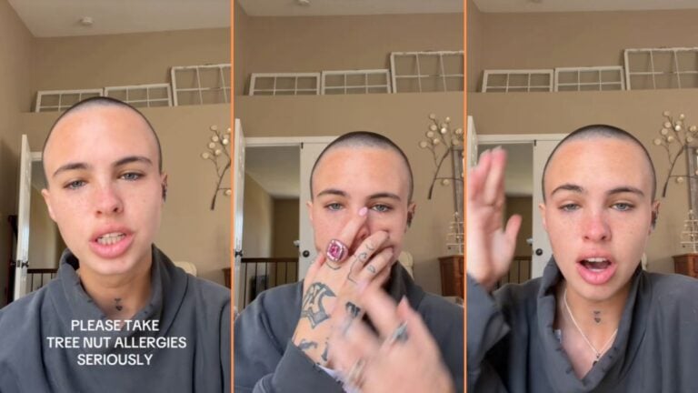 Restaurant Allegedly Gives Nuts to Allergic South Carolina Woman Even After Being Notified, 'Send the restaurant the bill'