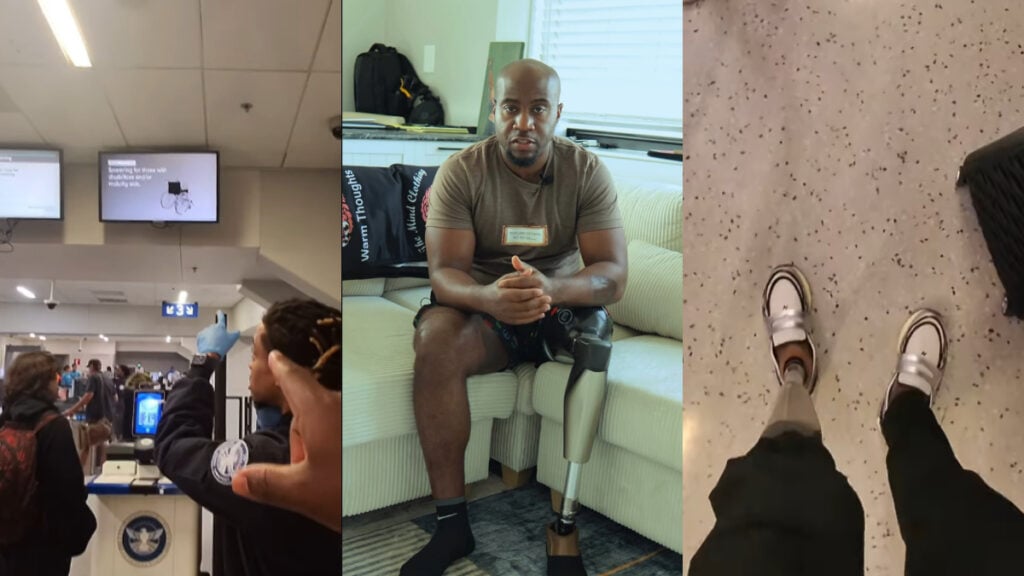 Airport denies disability access to man with prosthetic leg