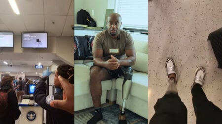 Airport denies disability access to man with prosthetic leg