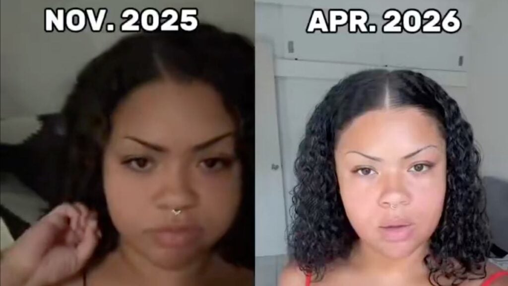 Utah TikToker Who Fled to Mexico Now Scrambling Back to the U.S. After Son’s Medical Emergency: ‘Guess the Grass Wasn’t Greener’ Meme-style viral X video contrasting a Utah TikToker's enthusiastic move to Playa del Carmen, Mexico in November 2025 with her April 2026 announcement that her family is returning to the US after her 4-year-old son's bacterial infection drained their savings.