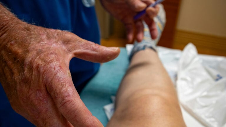 Doctor Hands Over Patient Leg