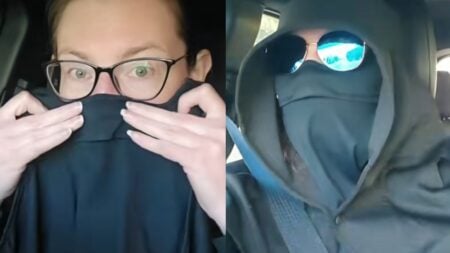 Tennessee Real-Life ‘Vampire’ Shares What Living With a Sun Allergy Looks Like