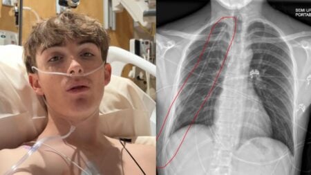 Arizona Man Records Emotional Video After Fifth Collapsed Lung Surgery