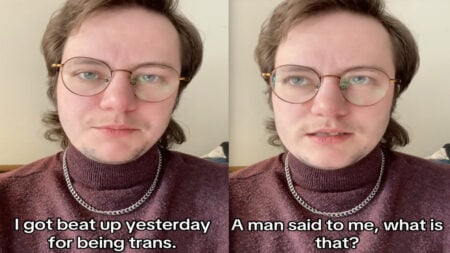Washington Man Shares Story of Brutal Assault That Cost Him a Tooth for Being Trans