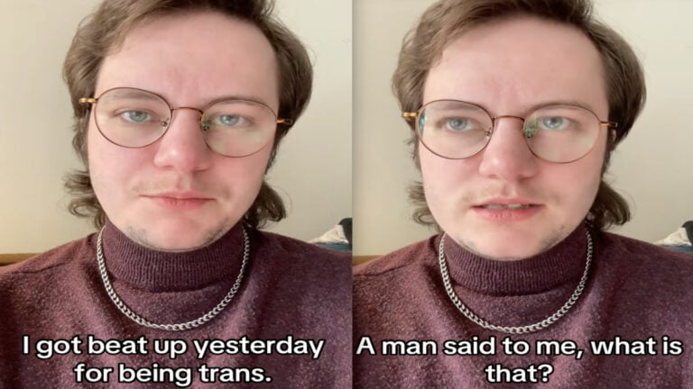 Washington Man Shares Story of Brutal Assault That Cost Him a Tooth for Being Trans