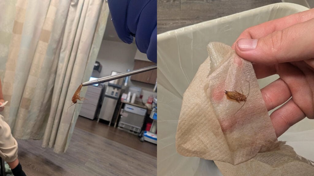 Florida Man Says Cockroach Flew Into His Ear and Wouldn’t Come Out: ‘Actually Horrifying’ Florida Man Says Cockroach Flew Into His Ear and Wouldn’t Come Out: ‘Actually Horrifying’