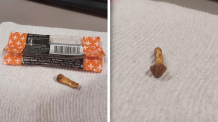 ‘Some Employee Is Looking for That Finger’: Oklahoma Worker Finds Possible Human Finger Bone in Workplace Snack Oklahoma Local Finds Possible Human Finger Bone in KIND Snack Bar