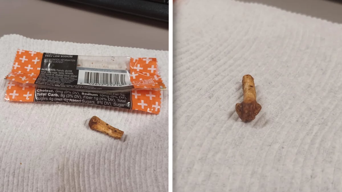 ‘Some Employee Is Looking for That Finger’: Oklahoma Worker Finds Possible Human Finger Bone in Workplace Snack