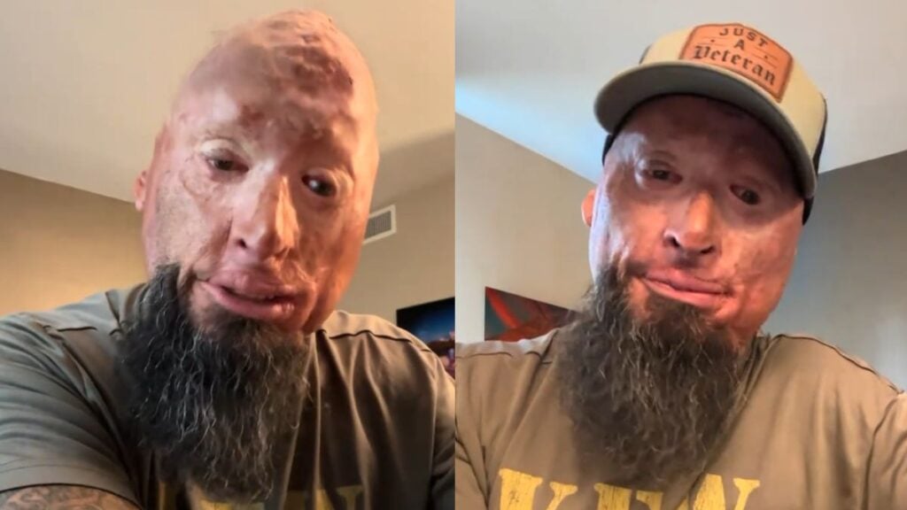 Young Girls Mock Veteran Burn Survivor at Kentucky Airport, Secretly Take Photos: ‘Raise Your Kids Right’ Young Girls Mock Veteran Burn Survivor at Kentucky Airport, Secretly Take Photos