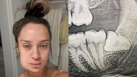 California Woman Says a Wisdom Tooth Removal Sent Her to the ER in Critical Condition: ‘Report Your Dentist to the State Board'