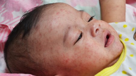 ‘MAGA Needs to Be Destroyed, They Are Killing Our Babies’: Pennsylvania Residents Blast Republicans as Deadly Measles Cases Soar to 1,286 pennsylvania babies measles MAGA republican